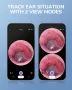 Професионален смарт отоскоп ScopeAround Otoscope Ear Camera, WiFi, снимка 7