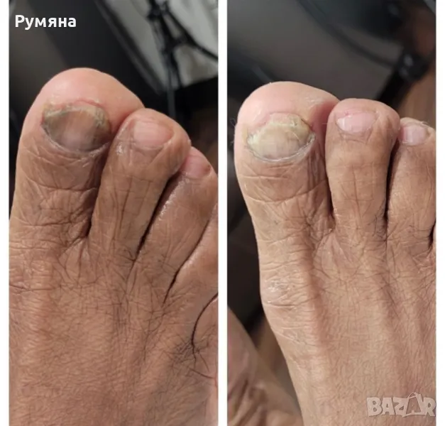 Пчелен мехлем за гъбички по ноктите и кожата , снимка 1