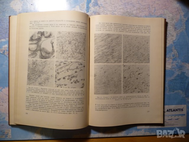 Алкохолни енцефалопатии в детската възраст Г. Узунов, С. Божинов, снимка 3 - Специализирана литература - 41523339