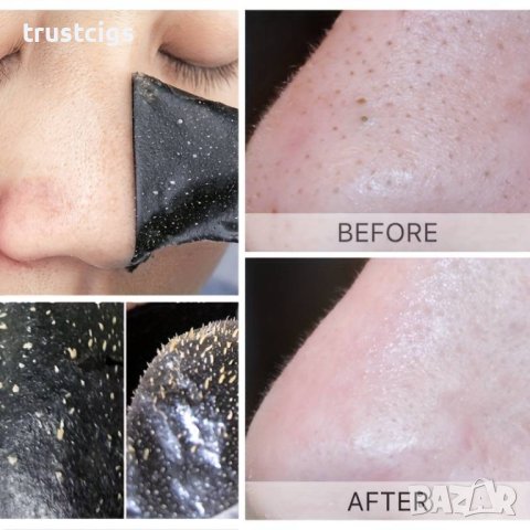 Ленти за премахване на черни точки от носа и лицето 15 бр., снимка 3 - Козметика за лице - 44481874