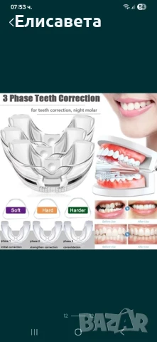Ортодонтски коректор за зъби
