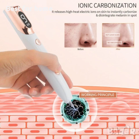 Електрически комплект за премахване на бенки с акумулаторна писалка с 9 нива, снимка 4 - Други - 53816471