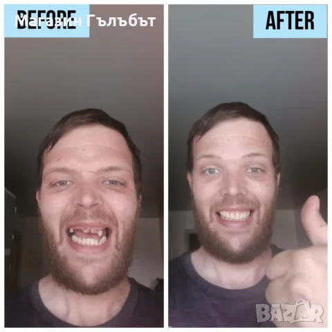 Instant Smile Lowers усмивка за минути /комплект от горни и долни зъби, снимка 3 - Стоматология - 56161110