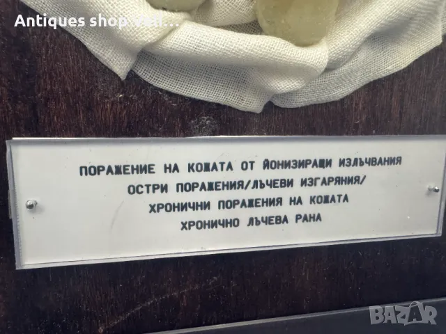 УНИКАЛНО Восъчни Ръчно Изработени Анатомични Мулажи КОЛЕКЦИЯ №69340 , снимка 2 - Антикварни и старинни предмети - 50402170