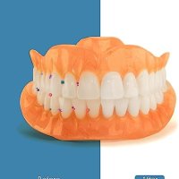 Нов Ултразвуково Почистване с UV за Протези Четки за зъби Бижута, снимка 3 - Други стоки за дома - 42626753