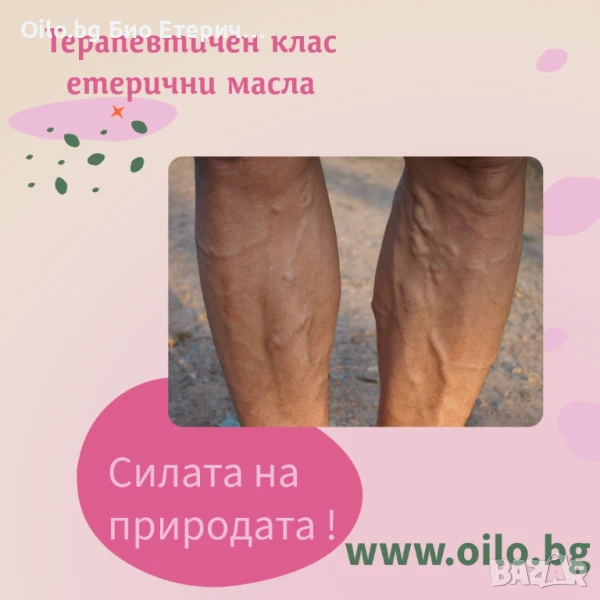 разширени вени на краката „Тежки крака? Отоци? Болка? 🌿 Решението е в силата на природата! Открий н, снимка 1