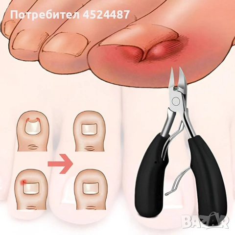 Професионален комплект за поддръжка на нокти – 5 части от неръждаема стомана., снимка 3 - Други - 53818203