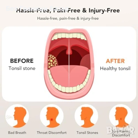 Нов Вакуумен уред за камъчета в сливиците 8 нива + LED, комплект 11 в 1, снимка 4 - Други - 53681731