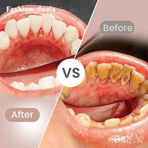 Нова USB акумулаторна електрически конец за зъби 280 ml резервоар за вода, снимка 3 - Други - 42507190