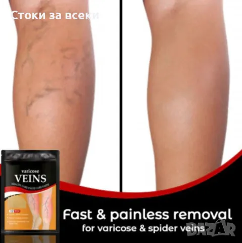 Здравен пластир за лечение на разширени вени Varicose Care Health Patch 12бр, снимка 3 - Козметика за тяло - 49173561