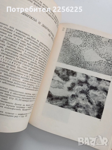 Диференциална диагноза на кръвните заболявания в детската възраст, снимка 8 - Специализирана литература - 53327974