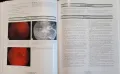 Атлас по ревматология / Atlas of Rheumatology, снимка 11