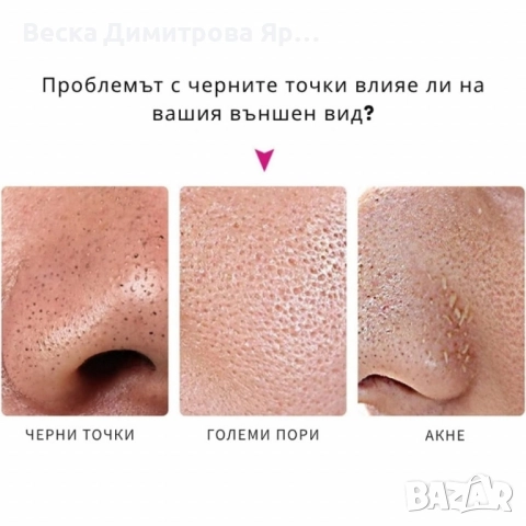 10 броя ленти за премахване на черни точки Nose Mask, снимка 7 - Козметика за лице - 51559153