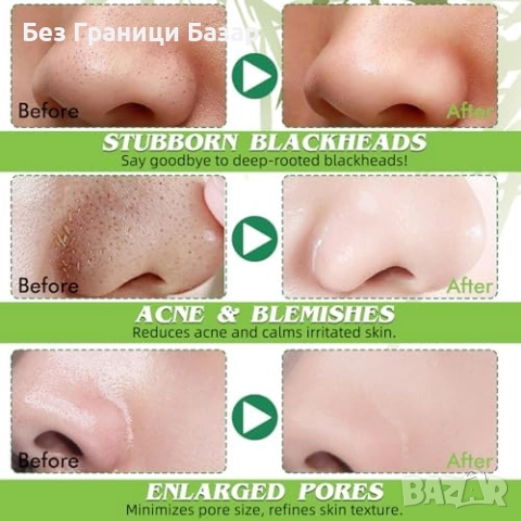 Нови Ленти против черни точки с активен въглен 10 броя – дълбоко почистване, снимка 2 - Други - 52772585