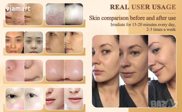 LED маска за лице и фотон терапия ForeverLily LM с 7 LED светлини, С червена светлина, Уред за подмл, снимка 9 - Друга електроника - 53119131