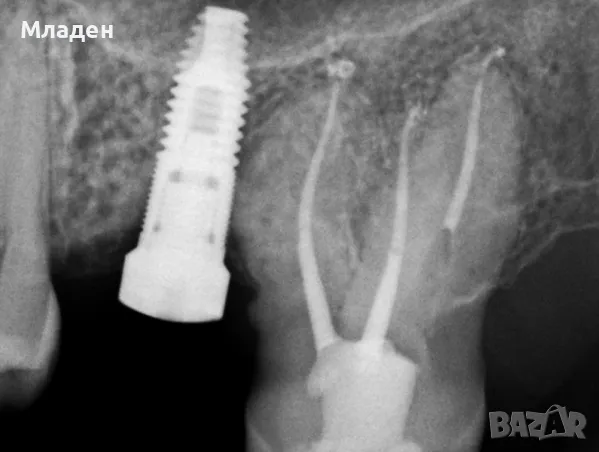 Дентален рентген за секторни снимки, снимка 3 - Медицинска апаратура - 48843215