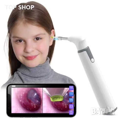 Професионален смарт отоскоп ScopeAround Otoscope Ear Camera, WiFi, снимка 10 - Уреди за диагностика - 48483362