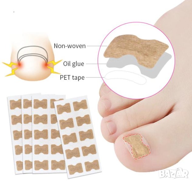 Инкрустирани Стикери за Нокти Защитна Подложка Промяна Ъгъла на Растеж Нежна и Безболезнена Корекция, снимка 1