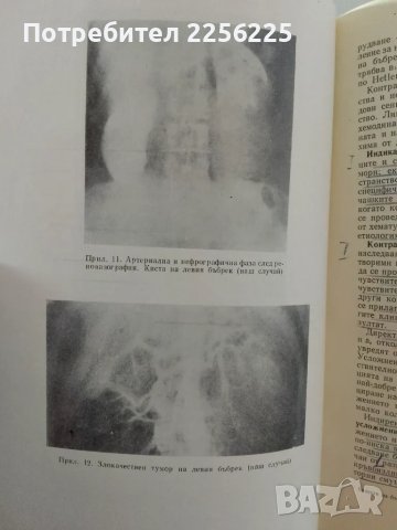 "Болести на бъбреците", снимка 5 - Специализирана литература - 47482021