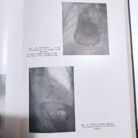 Учебник по рентгенова диагностика на вътрешните органи , снимка 2 - Специализирана литература - 41716433