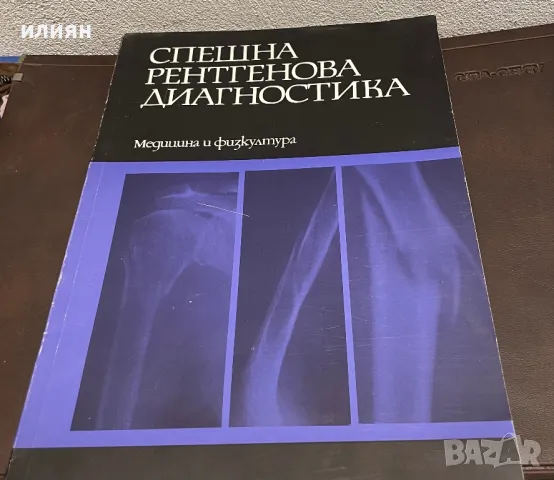 Спешна рентгенова диагностика, снимка 1