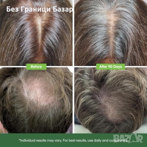 Нов Серум за коса рол он апликатор пластмасов флакон за лесно нанасяне, снимка 5 - Продукти за коса - 52943492