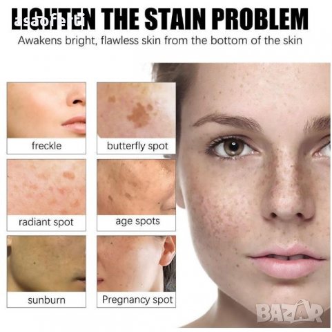 Control Green Cream избелващ крем, снимка 10 - Козметика за тяло - 39897994