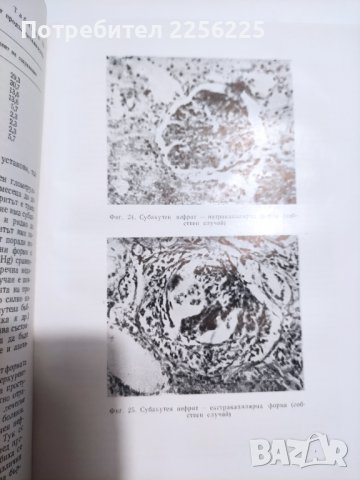 Ръководството по болести на бъбреците, снимка 2 - Специализирана литература - 41716594