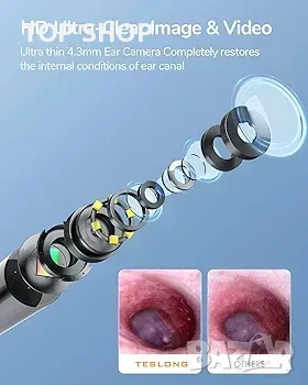 Цифров отоскоп Teslong с средство за премахване на ушна кал, снимка 3 - Друга електроника - 48777213