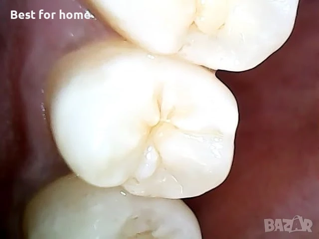  USB Дентална камера  MouthCAM, снимка 5 - Стоматология - 50721732