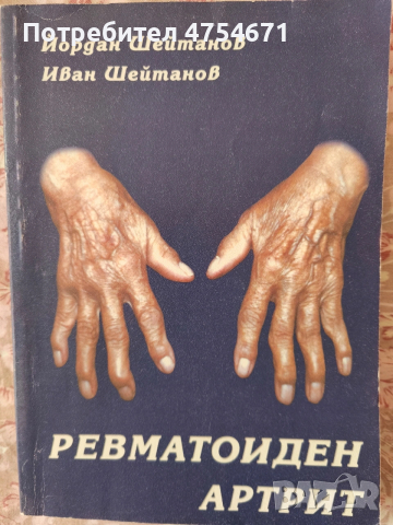 Ревматоиден артрит 