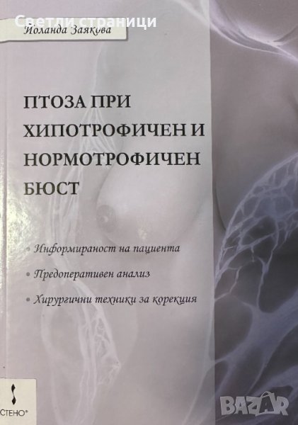 Птоза при хипотрофичен и нормотрофичен бюст - Йоланда Заякова, снимка 1