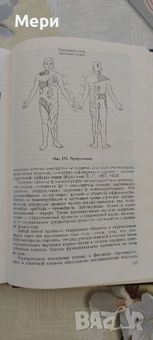 Иридодиагностика, снимка 7 - Други - 53768504