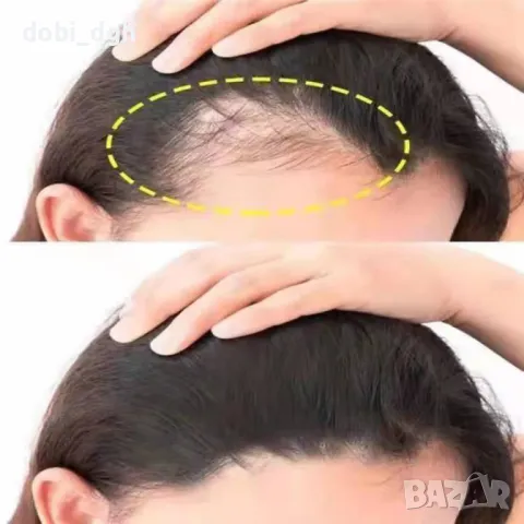 Серум за коса – растеж, заздравяване и сгъстяване, снимка 2 - Продукти за коса - 47384735