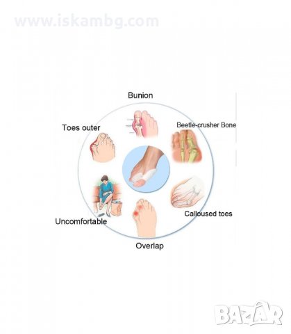 СИЛИКОНОВИ РАЗДЕЛИТЕЛИ СРЕЩУ ИЗПЪКНАЛИ КОКАЛЧЕТА - код FOOTMATE, снимка 7 - Други - 34061198