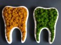 Подарък - За зъболекар и зъботехник - зъб със скандинавски мъх