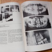 Атлас по стоматологична рентгенология- Димитър Маджаров, 1989год., снимка 2 - Специализирана литература - 43908995