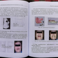 Ортопедична рехабилитация при увреждане в лицево-челюстната област Трифон Михайлов, снимка 7 - Специализирана литература - 36249531