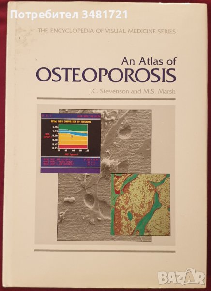 Атлас на остеопорозата / Atlas of Osteoporosis, снимка 1