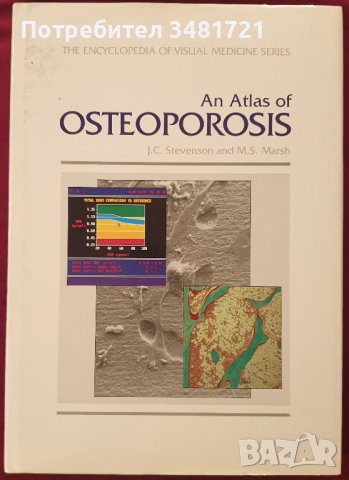 Атлас на остеопорозата / Atlas of Osteoporosis, снимка 1 - Енциклопедии, справочници - 41376795