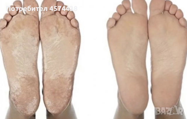 Водоустойчива Електрическа Пила за Пети - Внос от Англия, снимка 4 - Други - 52240922