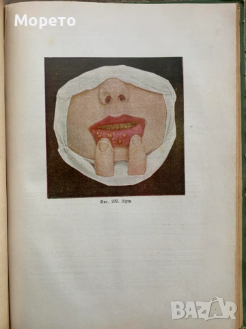Терапевтична стоматология-Димитър Свраков, снимка 5 - Специализирана литература - 52863831