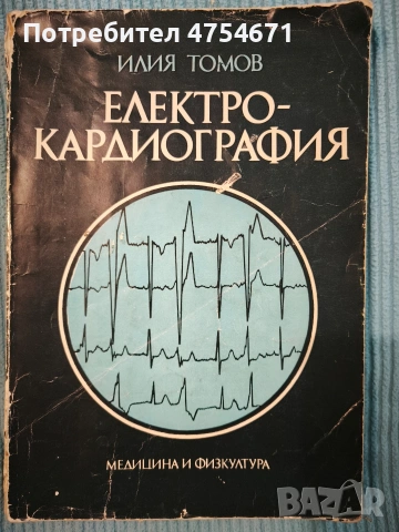 Електрокардиография 