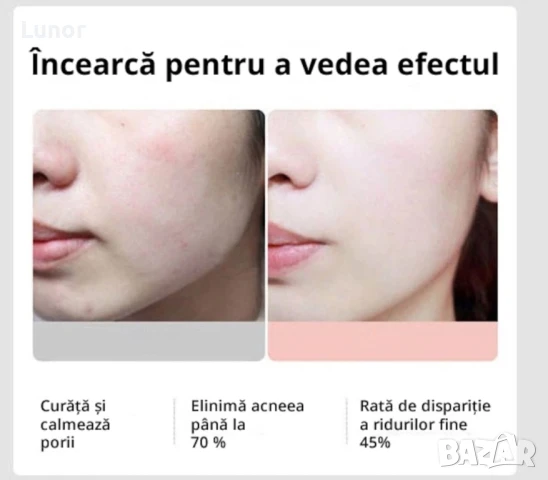 Многофункционален уред за лице 5 в 1, снимка 3 - Козметика за лице - 51340635