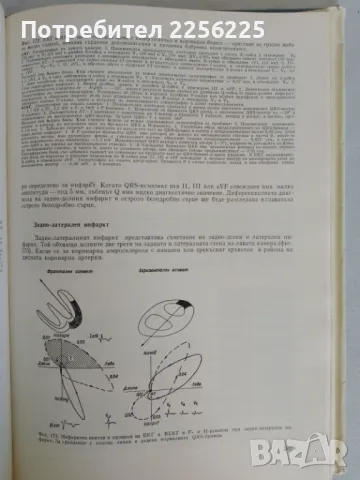 Клинична електро кардиография и вектор кардиография, снимка 3 - Специализирана литература - 47534351