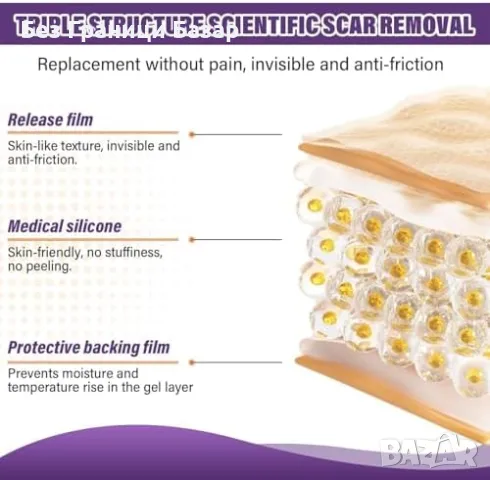 Нова Силиконова лепенка за белези – ефективно намалява стрии, снимка 4 - Други - 49294914