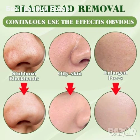 Нови 10 броя Въгленови ленти за пори – дълбоко почистване на нос точки, снимка 4 - Козметика за лице - 53694081