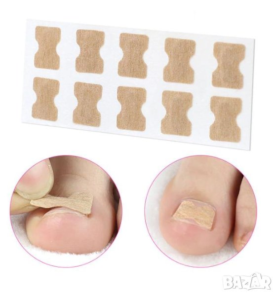 Пластири за Нокти Без Нужда от Лепило Кандида Корекция Изправяне Изкривен Обърнат Деформиран Нокът, снимка 1