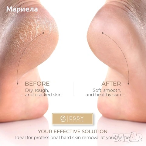 Електрическа пила за пети Essy , 5 ролки, снимка 5 - Други - 53536449