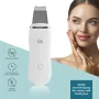Ултразвуков пилинг апарат VITALmaxx | Почистване на лице и вибрационен масаж с ултразвукова технолог, снимка 3